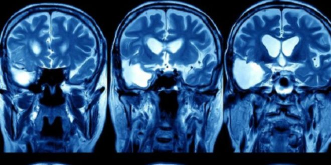 160831123428_deepmind_google_640x360__nocredit